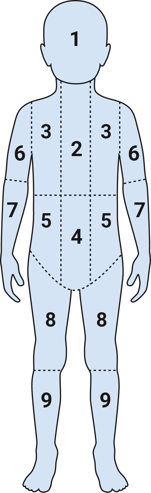 Diagram illustraNng the 9 skeletal regions included in a Curie score